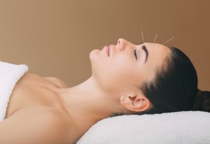 acupuncture treatments for headaches and migraines