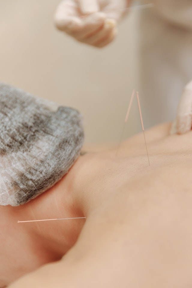 why people choose acupuncture