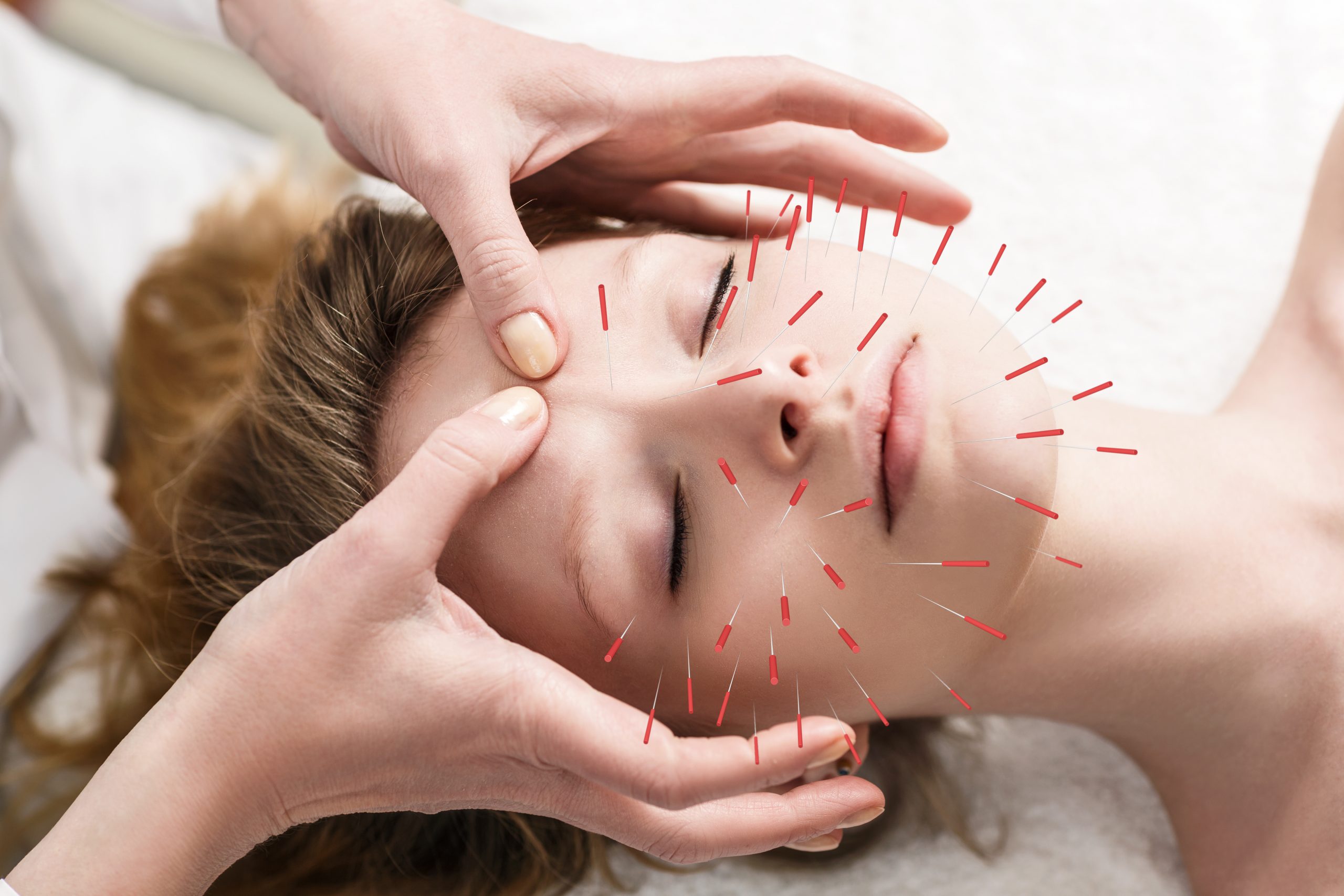 acupuncture as alternative treatment to pain